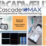 Sistem IONM Cascade IOMAX