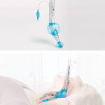 Tub laringian pentru intubatie cu tub de drenare iLTS-D